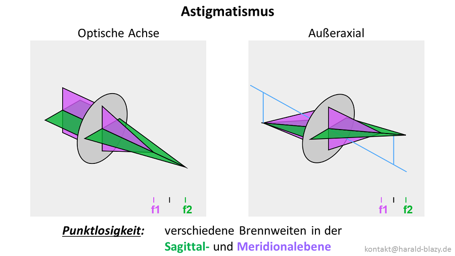 Astigmatismus